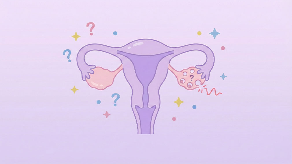 Illustration av livmoder och äggstockar där ena äggstocken visar utebliven ägglossning med frågetecken och smärtsymbol.